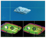 Input of reverse engineering for computerized 
correction and
production process